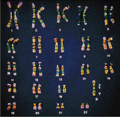 Chromosom kariotyp.gif